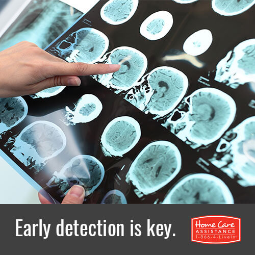 Alzheimers Detected on MRI